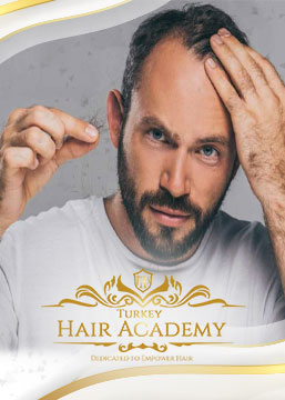 Is Hair Transplantation Correct While Hair Loss Continues?