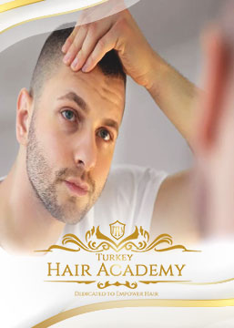 Is Hair Transplantation Permanent?